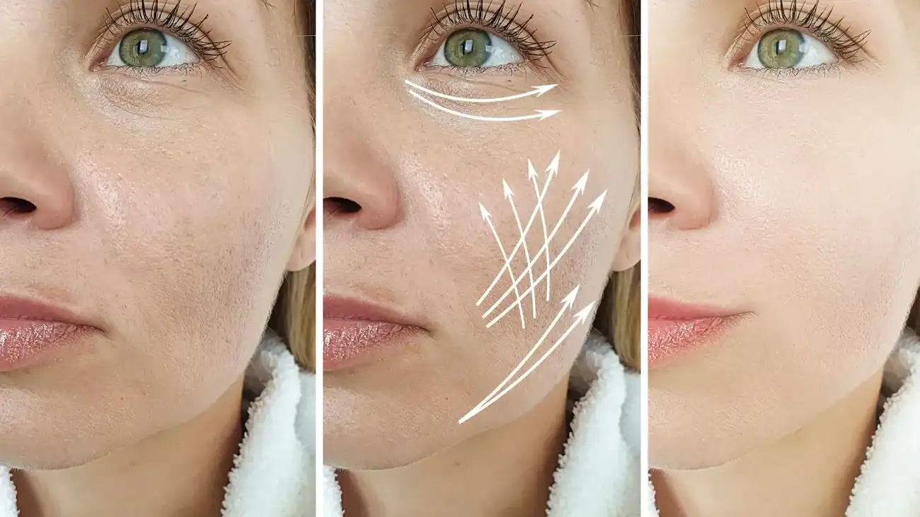 Can One Treatment Really Tackle More Than One Skin Concern Stroud?