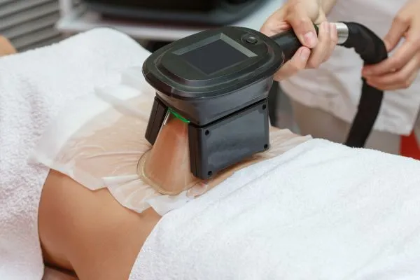Image of person having fat freezing treatment to help weight gain Stroud
