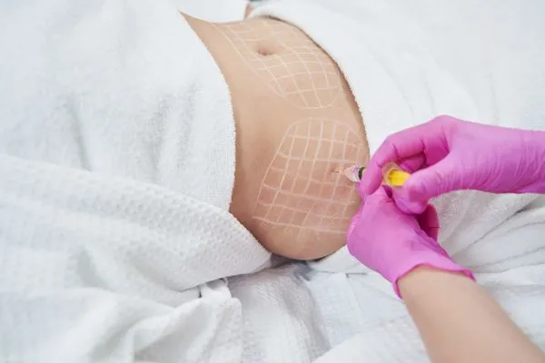 image of fat dissolving injections on love handles to help combat weight gain Stroud