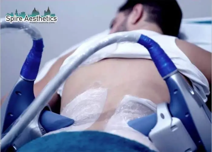 Man having fat freezing treatment done on love handles before a competitions Stroud to create a sculpted look.