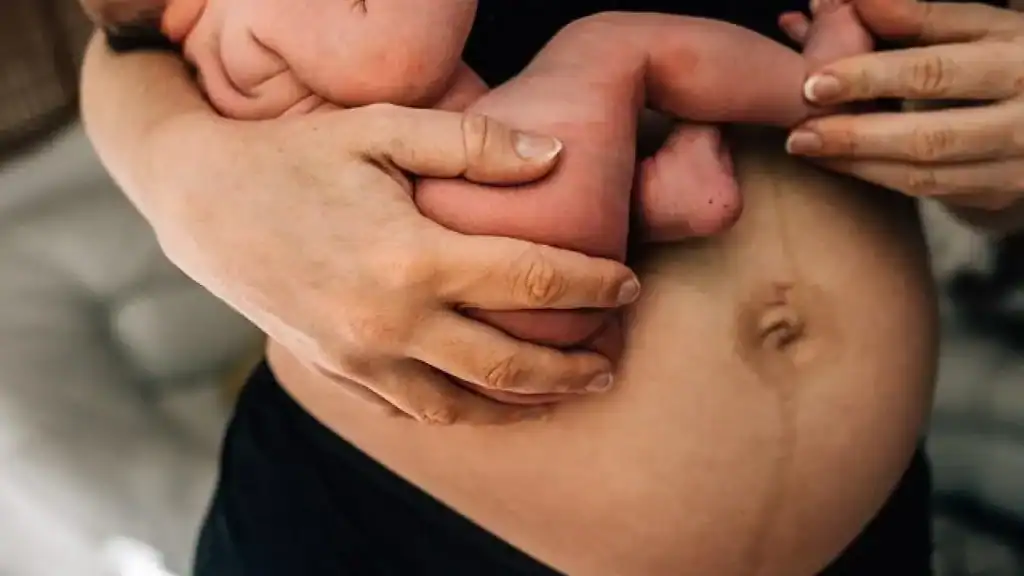 Why Is My Stomach Still Big After Pregnancy Stroud?
